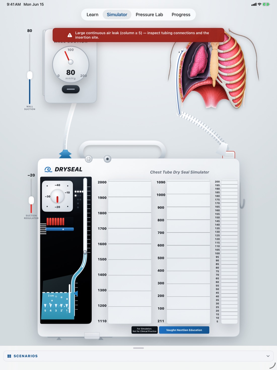 Chest Tube Simulator interface showing an interactive chest drainage system
