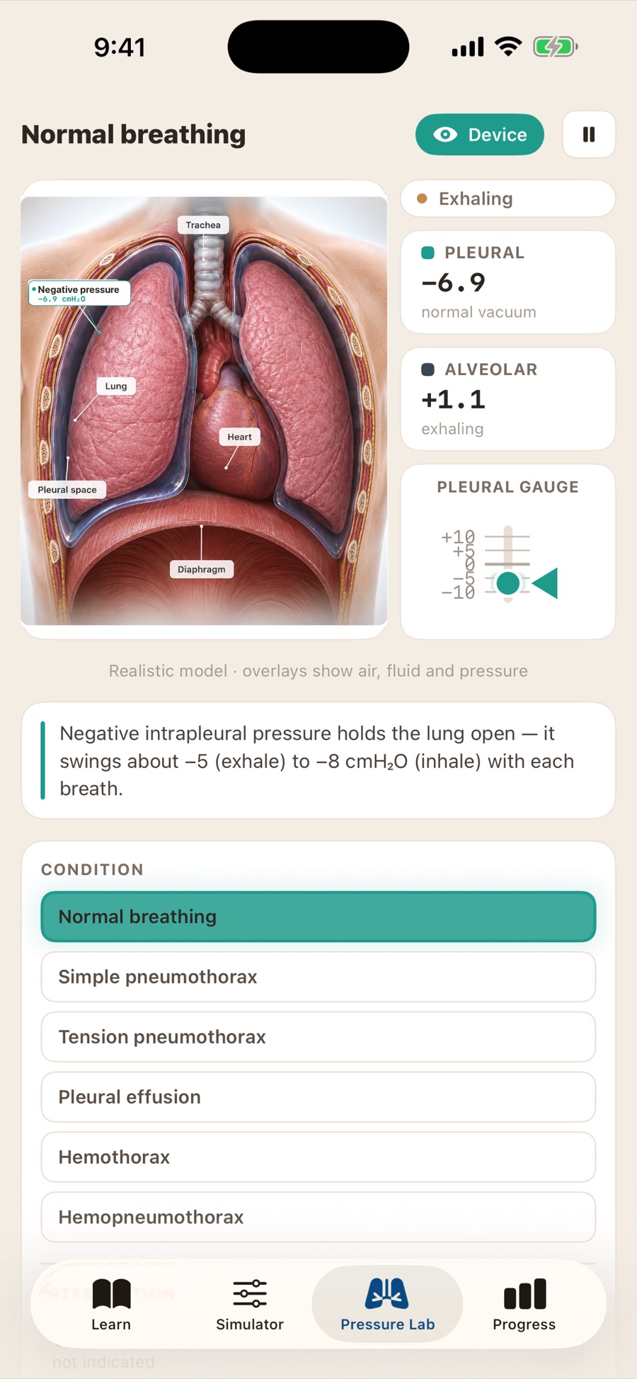 Pressure Lab screen showing a realistic thoracic anatomy model with a pleural pressure of −6.9 and alveolar readouts through the breathing cycle, beside a list of conditions such as pneumothorax and pleural effusion