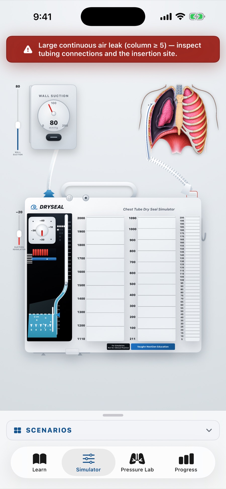 Chest Tube Simulator on iPhone showing the animated dry-suction chest drainage unit with a red large-continuous-air-leak alert, wall-suction regulator at 80 mmHg, a suction dial at −20, a water-seal chamber, and graduated collection columns