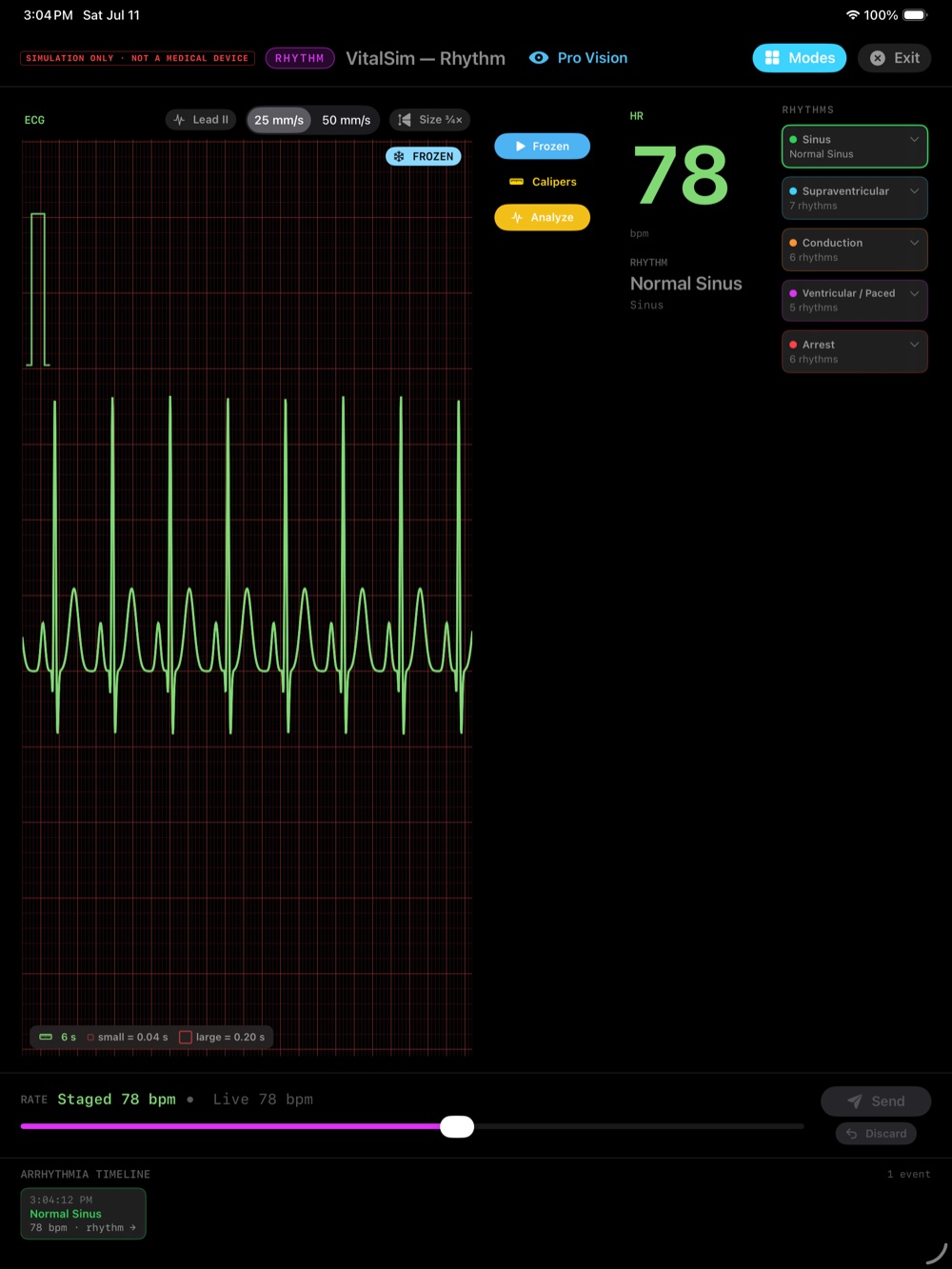 VitalSim Rhythm ECG trainer interface with a rhythm waveform
